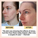 Kaolin Clay Face Mask