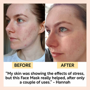 Kaolin Clay Face Mask