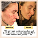 Kaolin Clay Face Mask