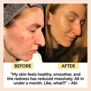 Kaolin Clay Face Mask
