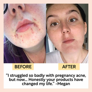 Hydration Skincare Set