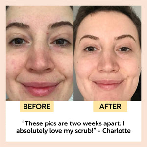 Natural Face Scrub – Citrus Blend for Dry Skin