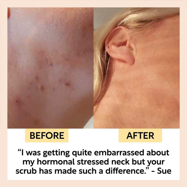 Natural Face Scrub – Citrus Blend for Dry Skin