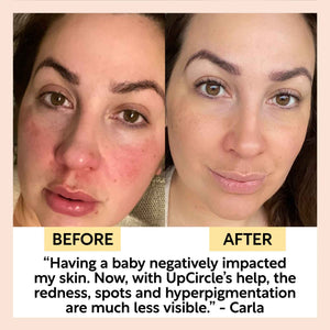 Day + Night Hydration Set