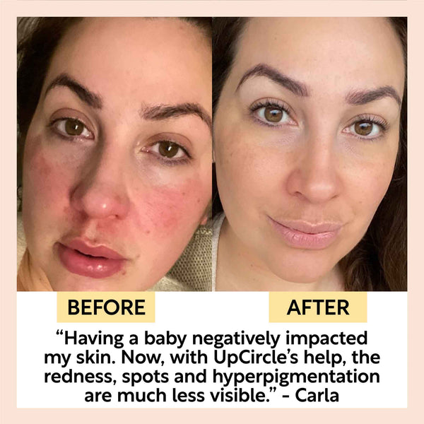 Day + Night Hydration Set