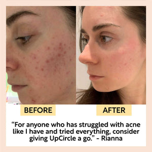 Face Toner with Hyaluronic Acid - Travel Size
