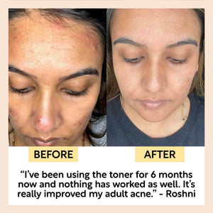 Face Toner with Hyaluronic Acid - Travel Size