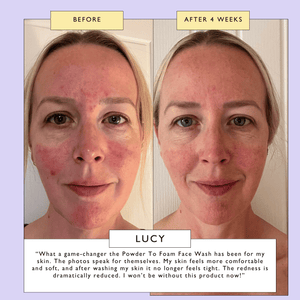 Powder to Foam Face Wash with Willow Bark + Papaya Enzymes