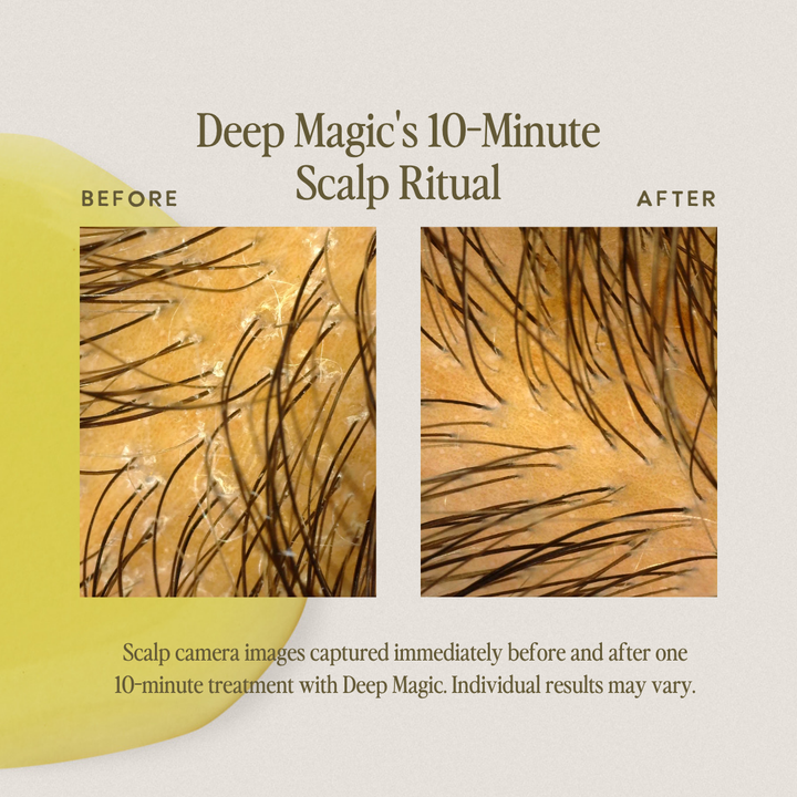 Deep Magic Hair + Scalp Serum