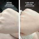 The Complete Skincare Collection