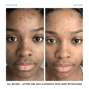 The Complete Skincare Collection