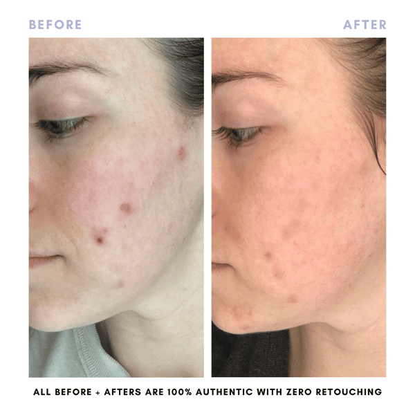 The Complete Skincare Collection