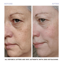 The Revive + Restore Skin Set | Anti-Aging + Skin Barrier Support Essential