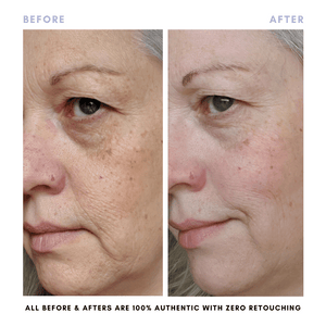 The Revive + Restore Skin Set | Anti-Aging + Skin Barrier Support Essential