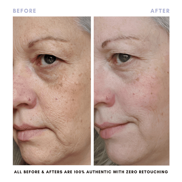 The Revive + Restore Skin Set | Anti-Aging + Skin Barrier Support Essential