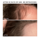 The Hair + Skin Boosting Bundle