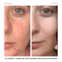 The Balancing Treatment Duo