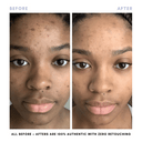 The Balancing Treatment Duo