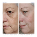 The Balancing Treatment Duo