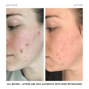 The Balanced Skin Set (Travel-Size)